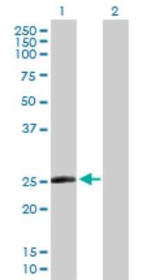 Western Blot: TAF10 Antibody [H00006881-D01P]