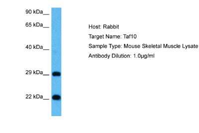 Western Blot: TAF10 Antibody [NBP2-85866]
