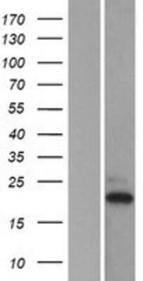 Western Blot: TAF10 Overexpression Lysate [NBP2-07647]