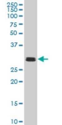 Western Blot: TAF11 Antibody (2G9) [H00006882-M04]