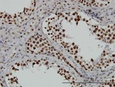 Immunohistochemistry-Paraffin: TAF11 Antibody (3D3) [H00006882-M01]