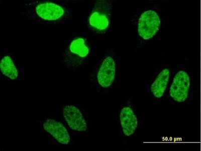 Immunocytochemistry/ Immunofluorescence: TAF11 Antibody (3E7) [H00006882-M07]