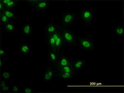 Immunocytochemistry/ Immunofluorescence: TAF11 Antibody (3G6) [H00006882-M06]