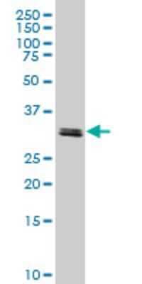 Western Blot: TAF11 Antibody (3G6) [H00006882-M06]