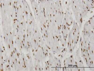 Immunohistochemistry-Paraffin: TAF11 Antibody (3H5) [H00006882-M03]