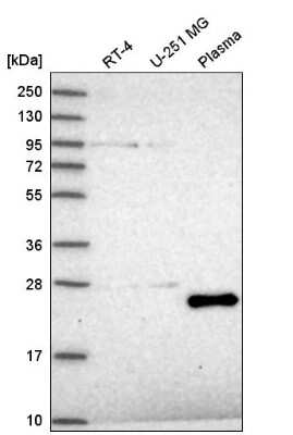 Western Blot: TAF11 Antibody [NBP2-55367]