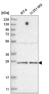 Western Blot: TAF11 Antibody [NBP2-58561]