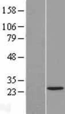 Western Blot: TAF11 Overexpression Lysate [NBL1-16680]