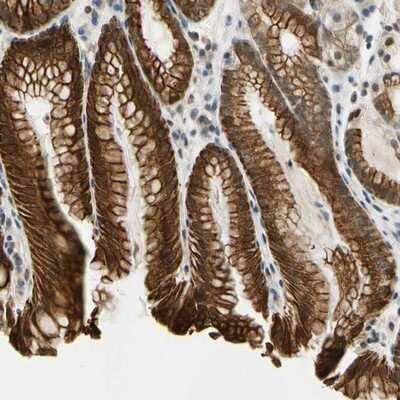 Immunohistochemistry-Paraffin: TAF12 Antibody [NBP1-80703]