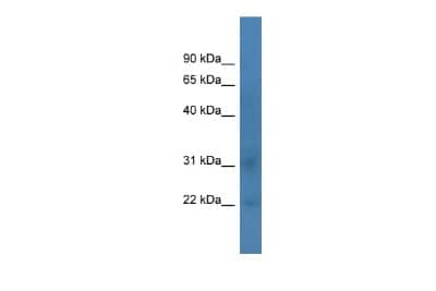 Western Blot: TAF12 Antibody [NBP2-88402]