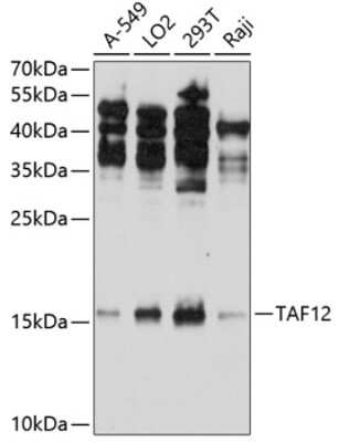 Western Blot: TAF12 AntibodyBSA Free [NBP2-93329]