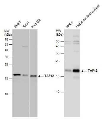 Western Blot: TAF12 Antibody [NBP3-12965]