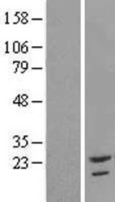 Western Blot: TAF12 Overexpression Lysate [NBL1-16681]