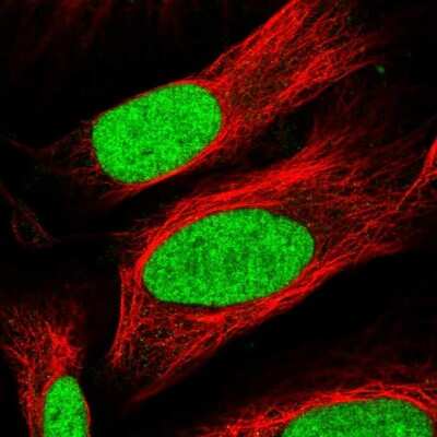 Immunocytochemistry/ Immunofluorescence: TAF13 Antibody [NBP1-92474]