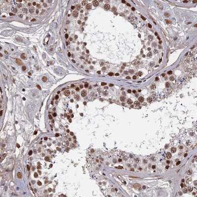 Immunohistochemistry-Paraffin: TAF13 Antibody [NBP1-92474]