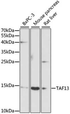 Western Blot: TAF13 AntibodyAzide and BSA Free [NBP2-93310]