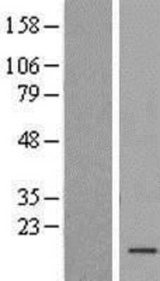 Western Blot: TAF13 Overexpression Lysate [NBP2-07724]