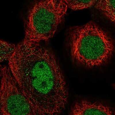 Immunocytochemistry/ Immunofluorescence: TAF148 Antibody [NBP2-47609]