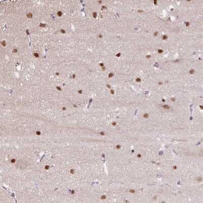Immunohistochemistry: TAF148 Antibody [NBP2-47609]