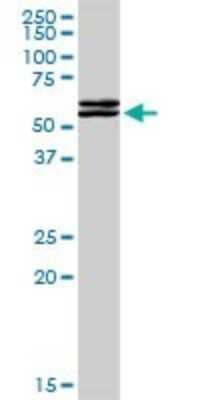 Western Blot: TAF148 Antibody [H00009015-D01P]