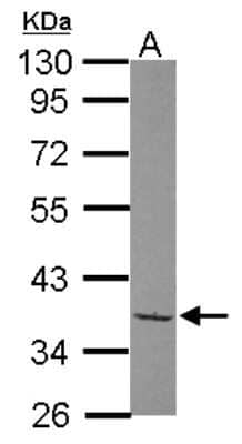 Western Blot: TAF148 Antibody [NBP2-20555]