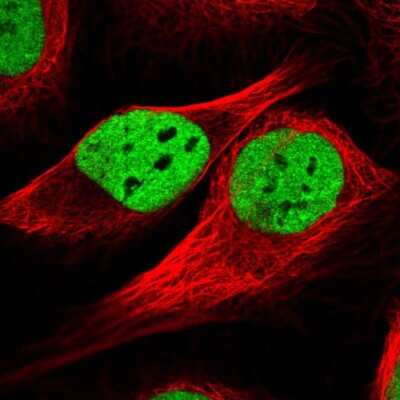 Immunocytochemistry/ Immunofluorescence: TAF15 Antibody [NBP2-13410]