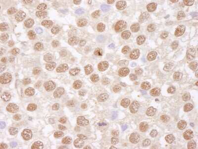 Immunohistochemistry-Paraffin: TAF15 Antibody [NB100-566]