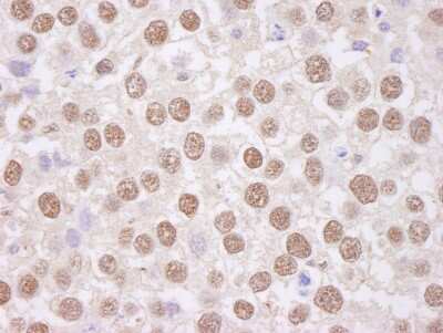Immunohistochemistry-Paraffin: TAF15 Antibody [NB100-567]