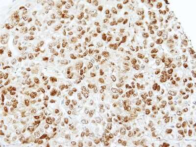 Immunohistochemistry-Paraffin: TAF15 Antibody [NBP1-32461]