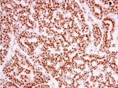 Immunohistochemistry-Paraffin: TAF15 Antibody [NBP1-32461]
