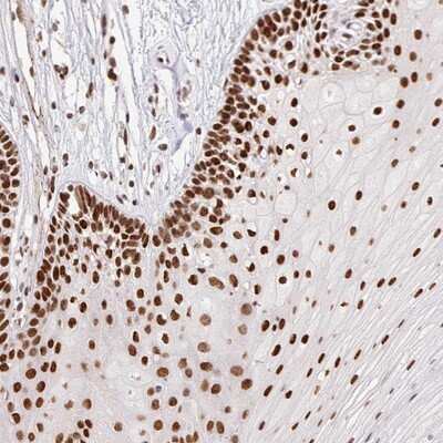 Immunohistochemistry-Paraffin: TAF15 Antibody [NBP2-13410]