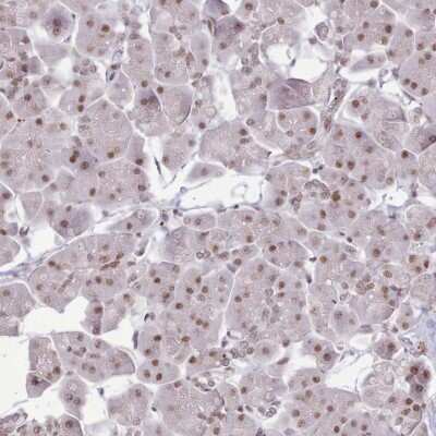 Immunohistochemistry-Paraffin: TAF15 Antibody [NBP2-13410]