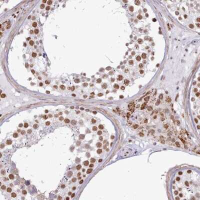 Immunohistochemistry-Paraffin: TAF15 Antibody [NBP2-13410]