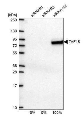 Western Blot: TAF15 Antibody [NBP2-57720]