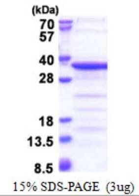 SDS-PAGE: Recombinant Human TAF15 His Protein [NBP2-22848]