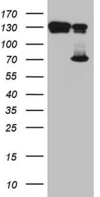 Western Blot: TAF1B Antibody (OTI1A8) [NBP2-46059]