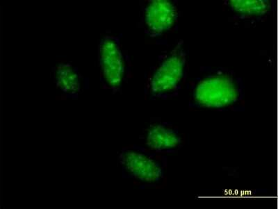 Immunocytochemistry/ Immunofluorescence: TAF1B Antibody [H00009014-B01P]