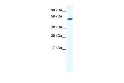 Western Blot: TAF1B Antibody [NBP2-82353]