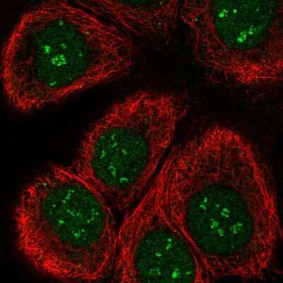 Immunocytochemistry/ Immunofluorescence: TAF1C Antibody [NBP2-58841]