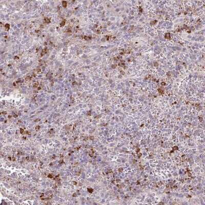 Immunohistochemistry-Paraffin: TAF1D Antibody [NBP2-31616]