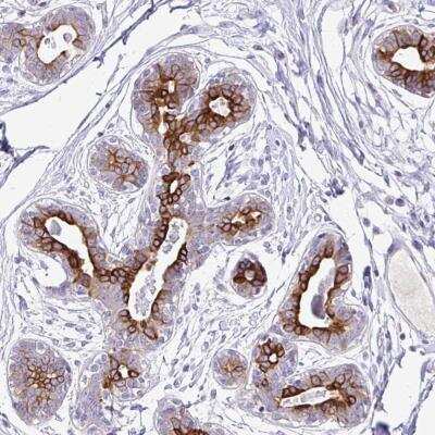 Immunohistochemistry-Paraffin: TAF1D Antibody [NBP2-31821]