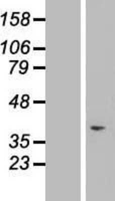 Western Blot: TAF1D Overexpression Lysate [NBL1-12110]