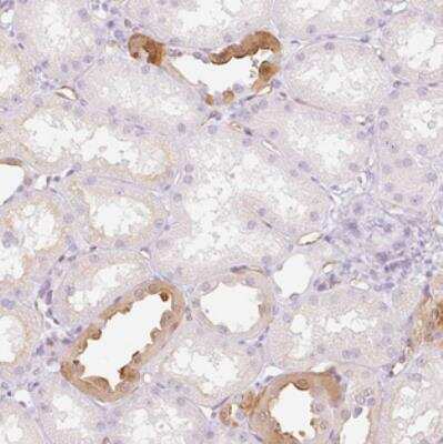 Immunohistochemistry-Paraffin: TAF1L Antibody [NBP2-30752]