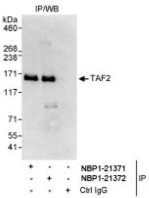 Immunoprecipitation: TAF2 Antibody [NBP1-21372]