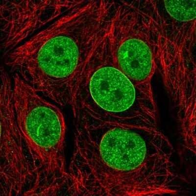 Immunocytochemistry/ Immunofluorescence: TAF3 Antibody [NBP2-55698]