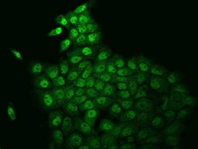 Immunocytochemistry/ Immunofluorescence: TAF4B Antibody [NBP2-98110]