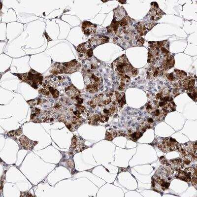 Immunohistochemistry-Paraffin: TAF4B Antibody [NBP1-90657]