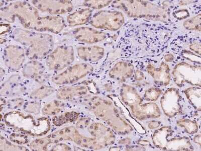 Immunohistochemistry-Paraffin: TAF4B Antibody [NBP2-98110]
