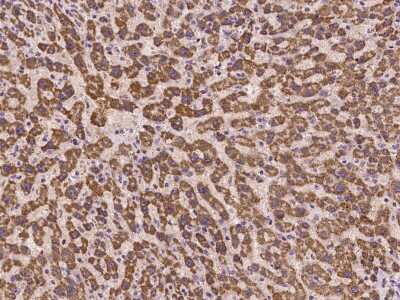 Immunohistochemistry-Paraffin: TAF4B Antibody [NBP2-98110]