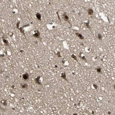 Immunohistochemistry-Paraffin: TAF5 Antibody [NBP1-86971]